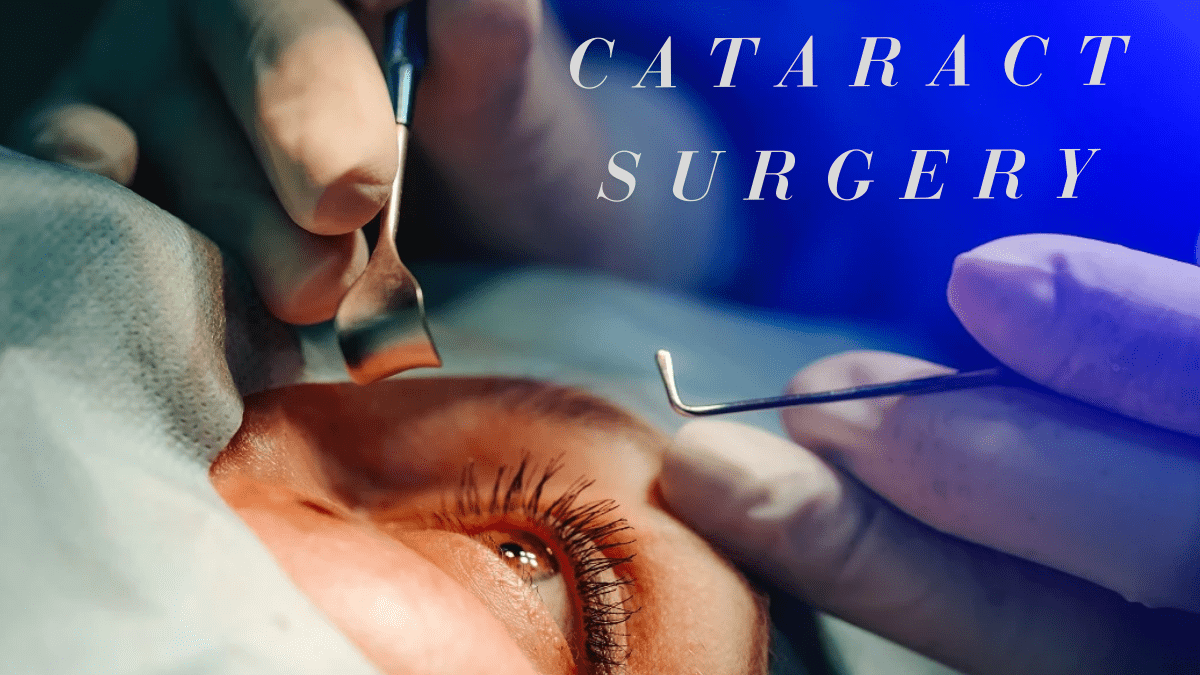 how long between cataract surgery on each eye